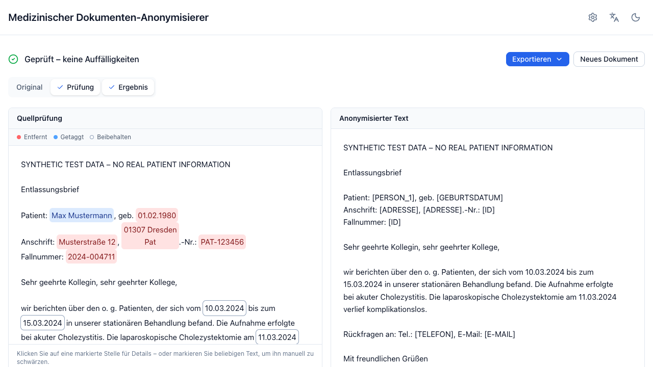 The result view: source review on the left, anonymized text on the right